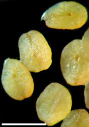 Veronica plebeia. Seeds. Scale = 1 mm.
 Image: P.J. Garnock-Jones © P.J. Garnock-Jones CC-BY-NC 3.0 NZ